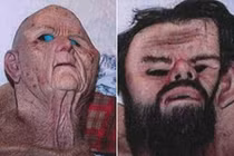 Bác sĩ bệnh hoạn xây hầm, bắt cóc và hãm hiếp phụ nữ