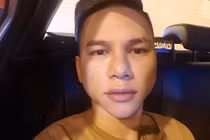 Gương mặt bị biến dạng, Hoàng Tôn tiếp tục dao kéo