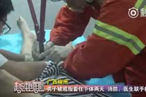 Khốn khổ thanh niên nghịch dại đeo nhẫn vào “cậu nhỏ“