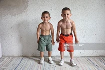 Mới 6 tuổi đã cuồn cuộn cơ bắp, ‘nhóc Hercules’ giờ lớn thế nào?