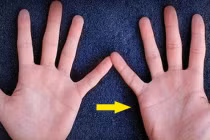 5 điểm chỉ có trên bàn tay tán lộc: Trẻ lận đận, về già chẳng đủ ăn