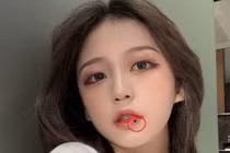 5 nốt ruồi mang quý nhân tới, ai sở hữu đều may mắn hơn người