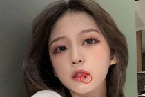 5 nốt ruồi mang quý nhân tới, ai sở hữu đều may mắn hơn người