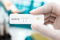 BS Khanh: F0 2 vạch coi chừng đang mắc 2 bệnh cùng lúc, đừng chủ quan