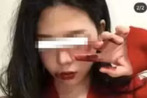 Loạt bạn trẻ xuất hiện với gương mặt bầm tím như bị bạo hành 