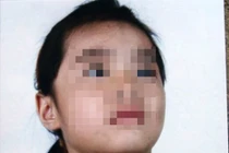 Tại sao chưa khởi tố kẻ hành hạ dã man bé 6 tuổi?