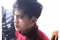 Đà Lạt: Nam thanh niên chém đối thủ vỡ sọ trong nhà WC