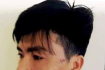 Đối tượng nghi say rượu đấm vào mặt CSCĐ khi bị dừng xe