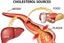 Tại sao rối loạn lipid máu nguy hiểm? 