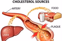 Tại sao rối loạn lipid máu nguy hiểm? 