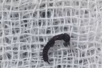 Hãi hùng pha “bắt” kiến xuyên thủng màng nhĩ bé gái 10 tuổi