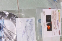 Bộ Y tế yêu cầu báo cáo sản phụ phá thai chui tử vong