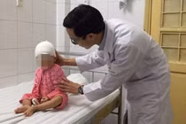 Bé gái 19 tháng tuổi mắc dị dạng hộp sọ hiếm gặp