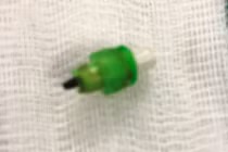 Thói quen ngậm bút chì khiến bé gái 7 tuổi suýt mất mạng