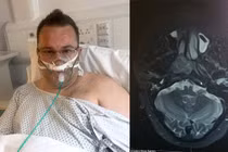 Bị cảm lạnh suốt 2 năm, người đàn ông bất ngờ vì nguyên nhân thật sự