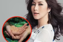 Cách nào để không mắc hội chứng tự lột da tay như Hương Tràm?