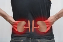 Suy thận cực kỳ nguy hiểm: Những dấu hiệu ai cũng cần biết