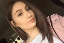 Cô gái 18 tuổi sưng húp mặt, mất thị lực vì nhuộm tóc