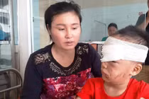 Bé trai 6 tuổi ở Thanh Hóa bị chó nhà cắn rách mặt