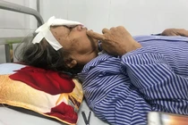 Nốt đen bất thường trên da ‘tố’ căn bệnh không ai ngờ tới