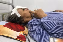 Nốt đen bất thường trên da ‘tố’ căn bệnh không ai ngờ tới