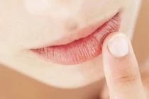 10 tuyệt chiêu cứu làn môi khô nứt mùa lạnh