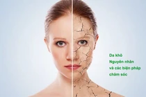 Bật mí 2 cách đắp mặt nạ giúp da hết khô, trắng hồng mịn màng