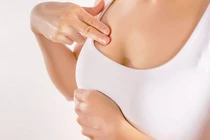 Có những dấu hiệu này chị em nhất định phải khám ung thư vú