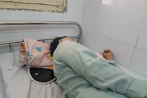 Ăn đầu gà, nữ bệnh nhân đau đớn nhập viện 