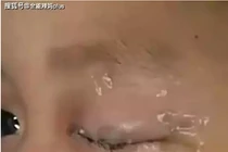 Bé 5 tuổi nhỏ keo 502 vào mắt, bác sĩ khen phản ứng của người cha