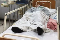 Hàng loạt người nhập viện vì ngộ độc rượu chứa methanol