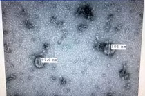 Việt Nam sắp có bộ kit xét nghiệm nhanh virus corona mới trong 2 giờ