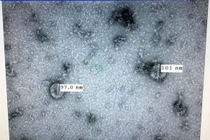 Việt Nam sắp có bộ kit xét nghiệm nhanh virus corona mới trong 2 giờ