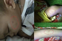 Tin mới nhất về bé 15 tháng tuổi bị trói chân tay bạo hành