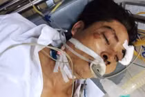 Nguy kịch khi đang tạm giam ở CA huyện: Bộ CA vào cuộc