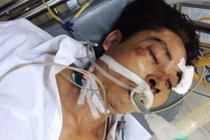 Nguy kịch khi đang tạm giam ở CA huyện: Bộ CA vào cuộc