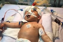 Bé trai 11 ngày tuổi bị đâm xuyên đầu có thể đột tử