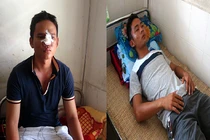 Rượt đuổi tấn công CSGT khiến 2 chiến sĩ vỡ mũi, chấn thương