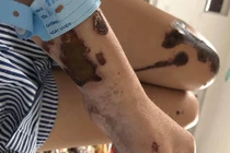 Tạt a xít vào vợ sắp cưới do bị từ hôn, thiếu úy ở Đà Nẵng bị tước quân tịch