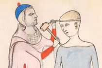 Hãi hùng kỹ thuật khoan hộp sọ của người cổ đại 