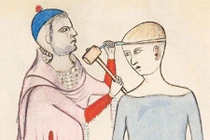 Hãi hùng kỹ thuật khoan hộp sọ của người cổ đại 