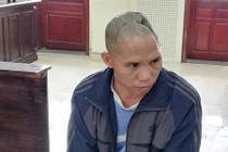 Cái kết cho kẻ giết người bị nạn nhân đánh mất nửa hộp sọ