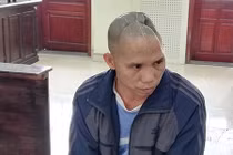 Cái kết cho kẻ giết người bị nạn nhân đánh mất nửa hộp sọ