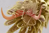 Sửng sốt hình ảnh chân muỗi đầy lông lá