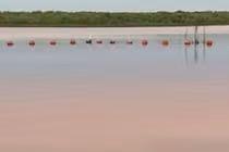 Bé gái 10 tuổi tự giải thoát khỏi hàm cá sấu thần kỳ