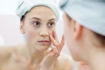 Dấu hiệu cảnh báo cơ thể bị thiếu kẽm 