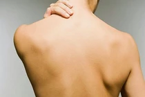 Vợ "cao thủ" vạch mặt chồng ngoại tình từ...cái mụn ở lưng