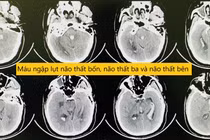 Người đàn ông bị đột quỵ khi đang ngồi làm việc