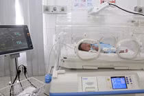 Một trẻ sơ sinh 22 ngày tuổi phình mạch não được cứu sống