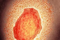 Bệnh đậu mùa khỉ đã lan ra 30 quốc gia